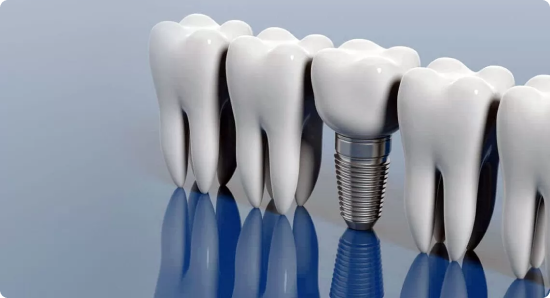Основные правила реабилитации после протезирования зубов