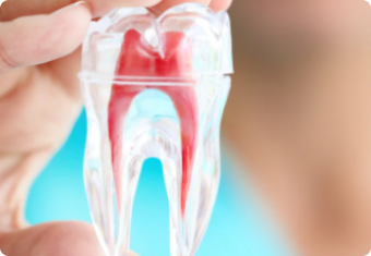 Лечение кариеса и пульпита в стоматологии